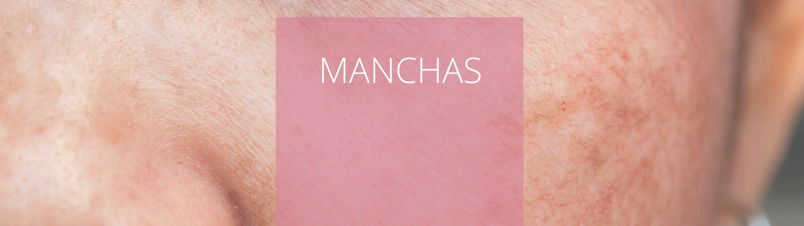 Manchas