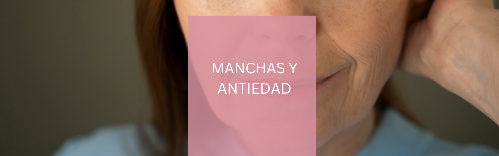 Manchas