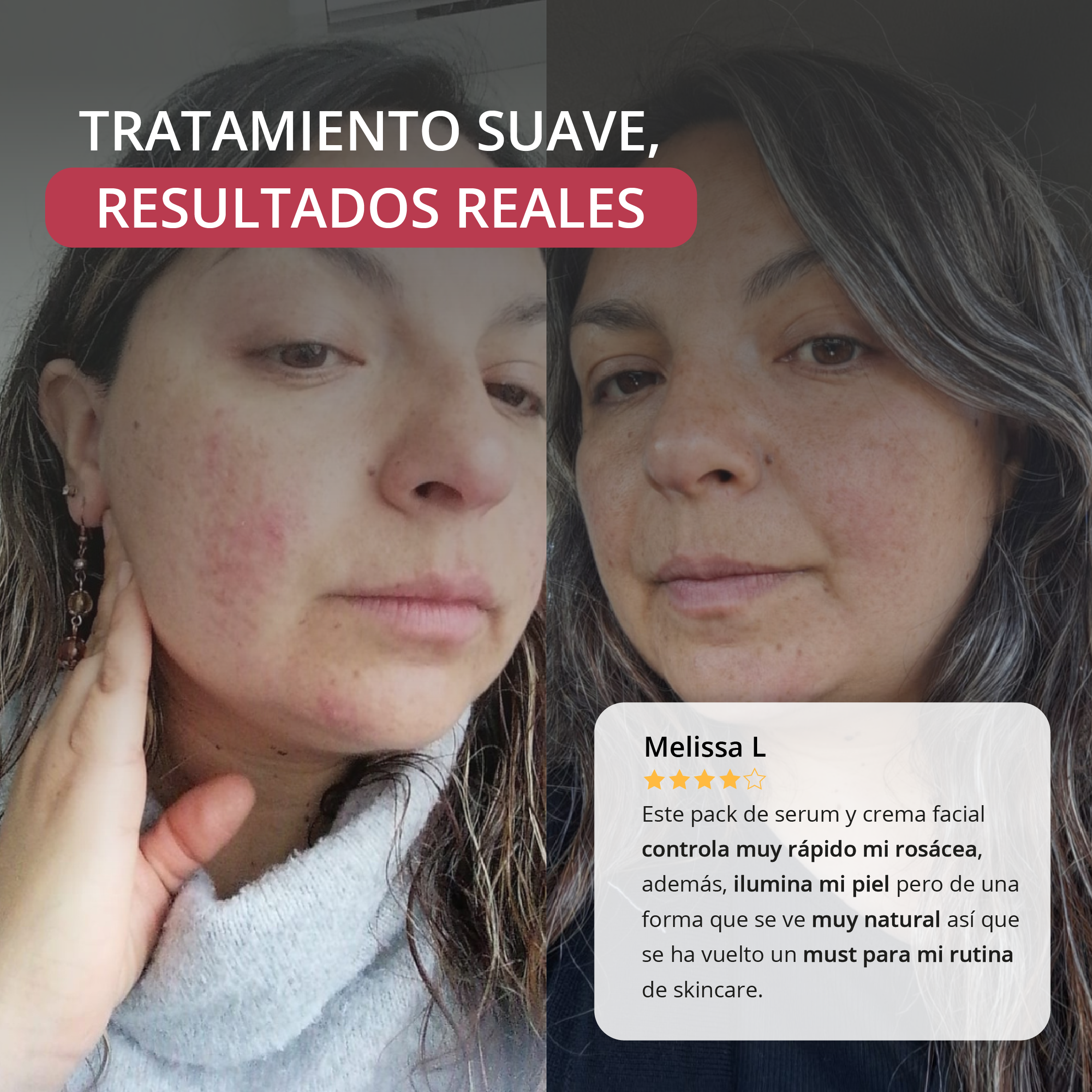 Pack Revitaliza tu Rostro - Newen Cosmetica