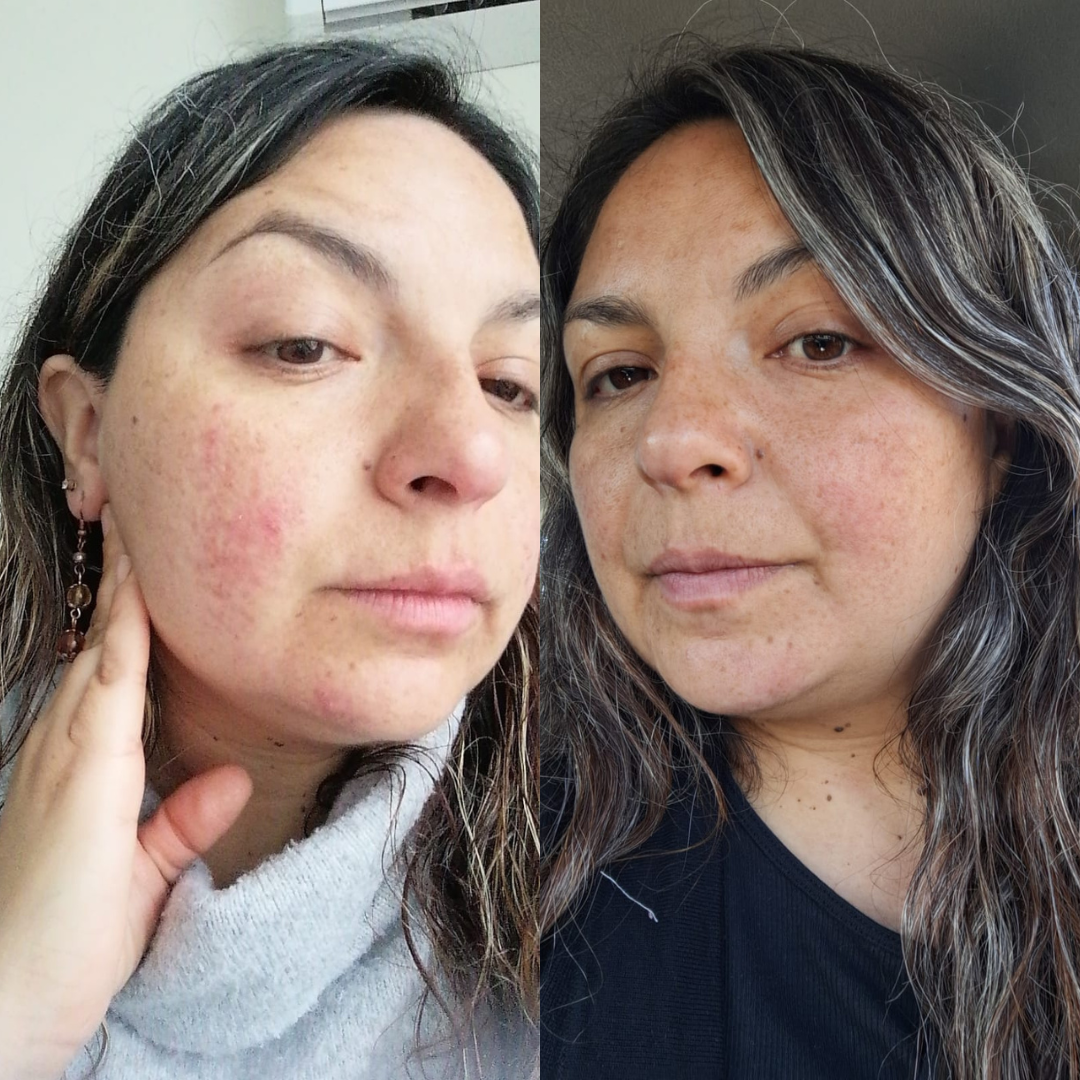 pack revitaliza.png__PID:0f206ac3-8fde-4008-8460-0052932edbab